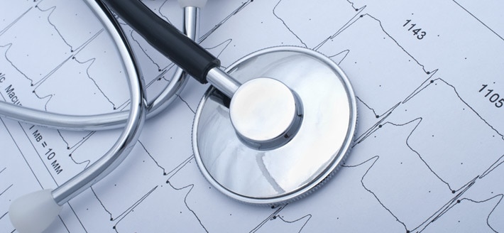 stethoscope sitting on heart monitor charts